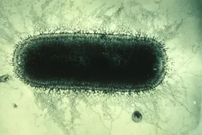 Transmission electron micrograph of a rod-shaped bacterium covered in hair-like fimbriae